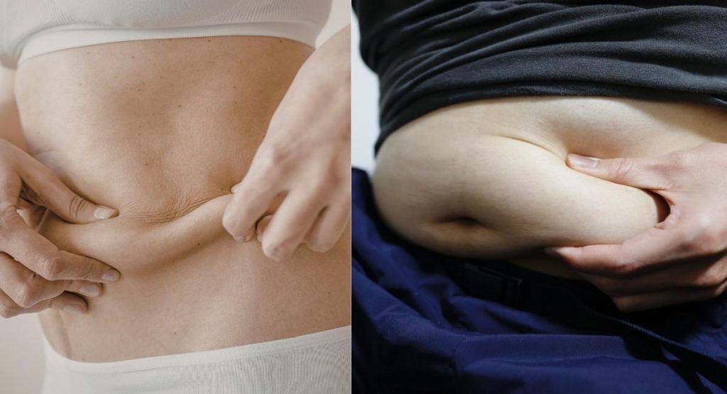 چربی احشایی و چربی زیرپوستی